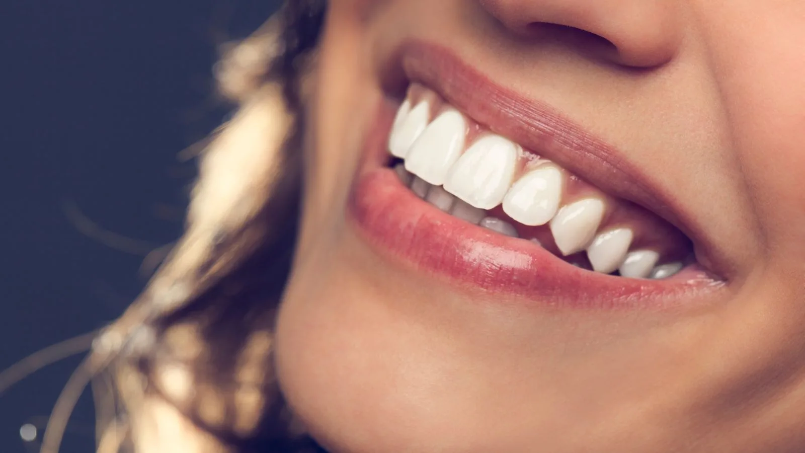 What Is a Hollywood Smile?